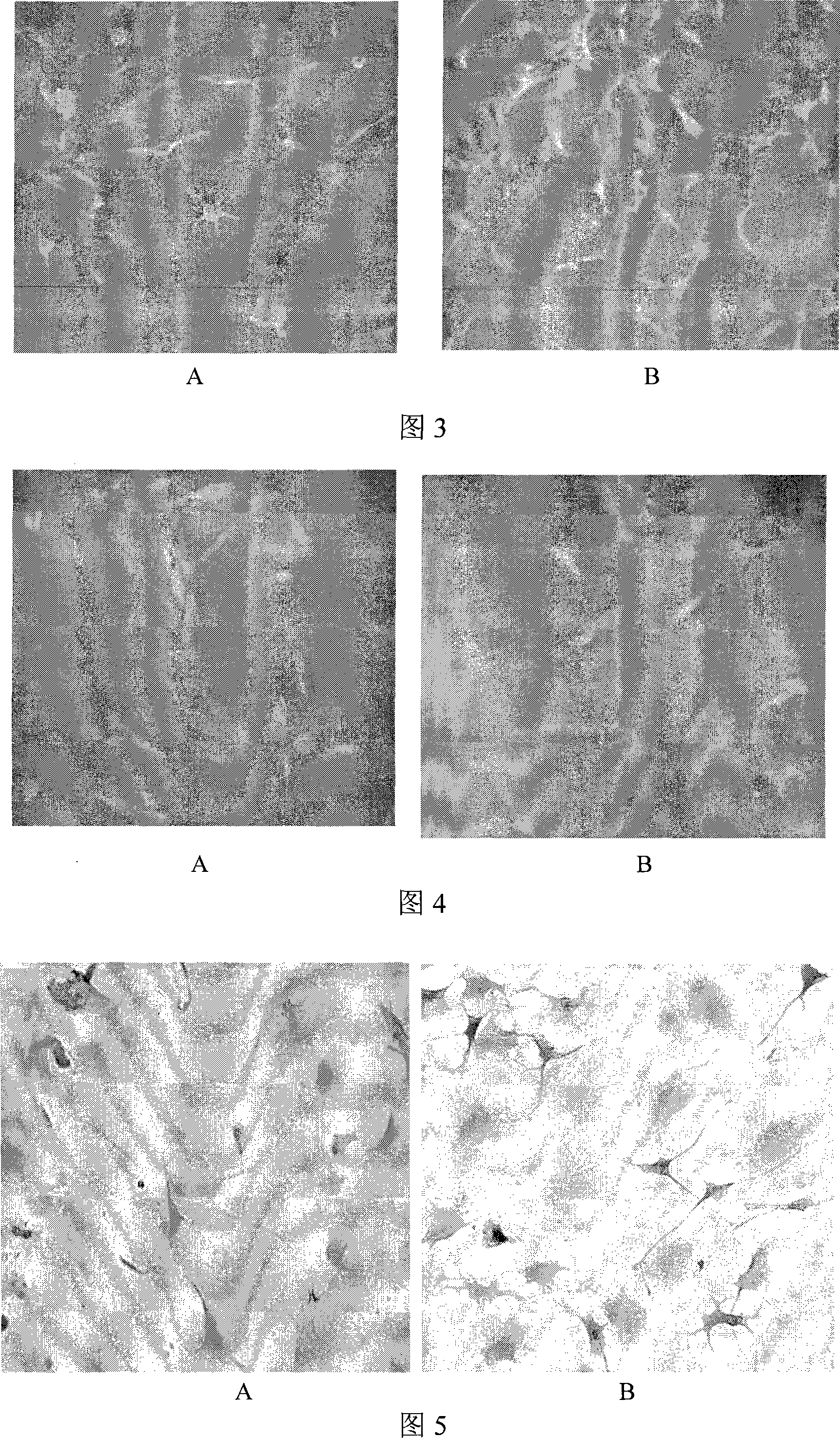 Method for obtaining neural progenitor cells induced by bone marrow mesenchymal stem cells