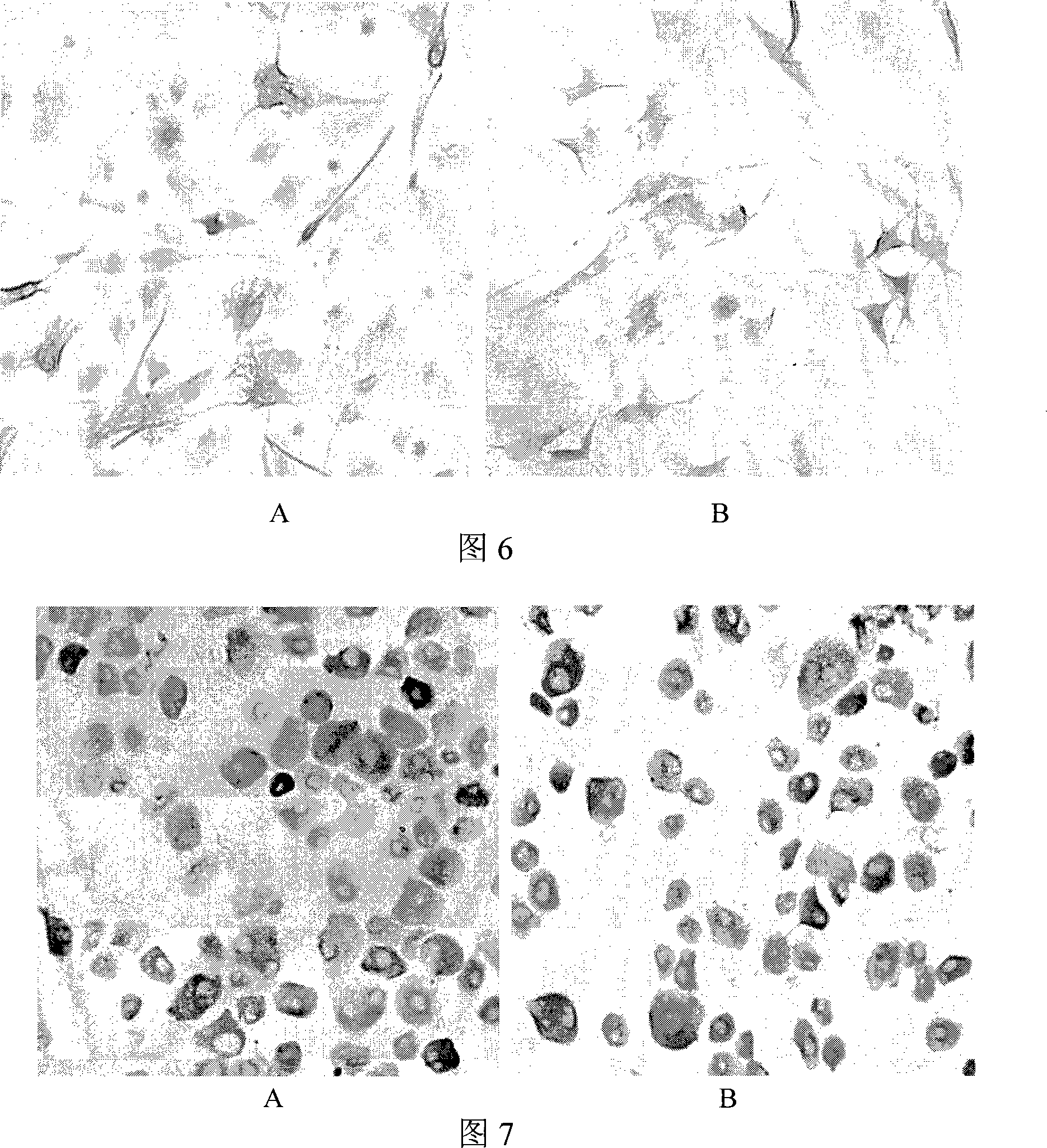 Method for obtaining neural progenitor cells induced by bone marrow mesenchymal stem cells