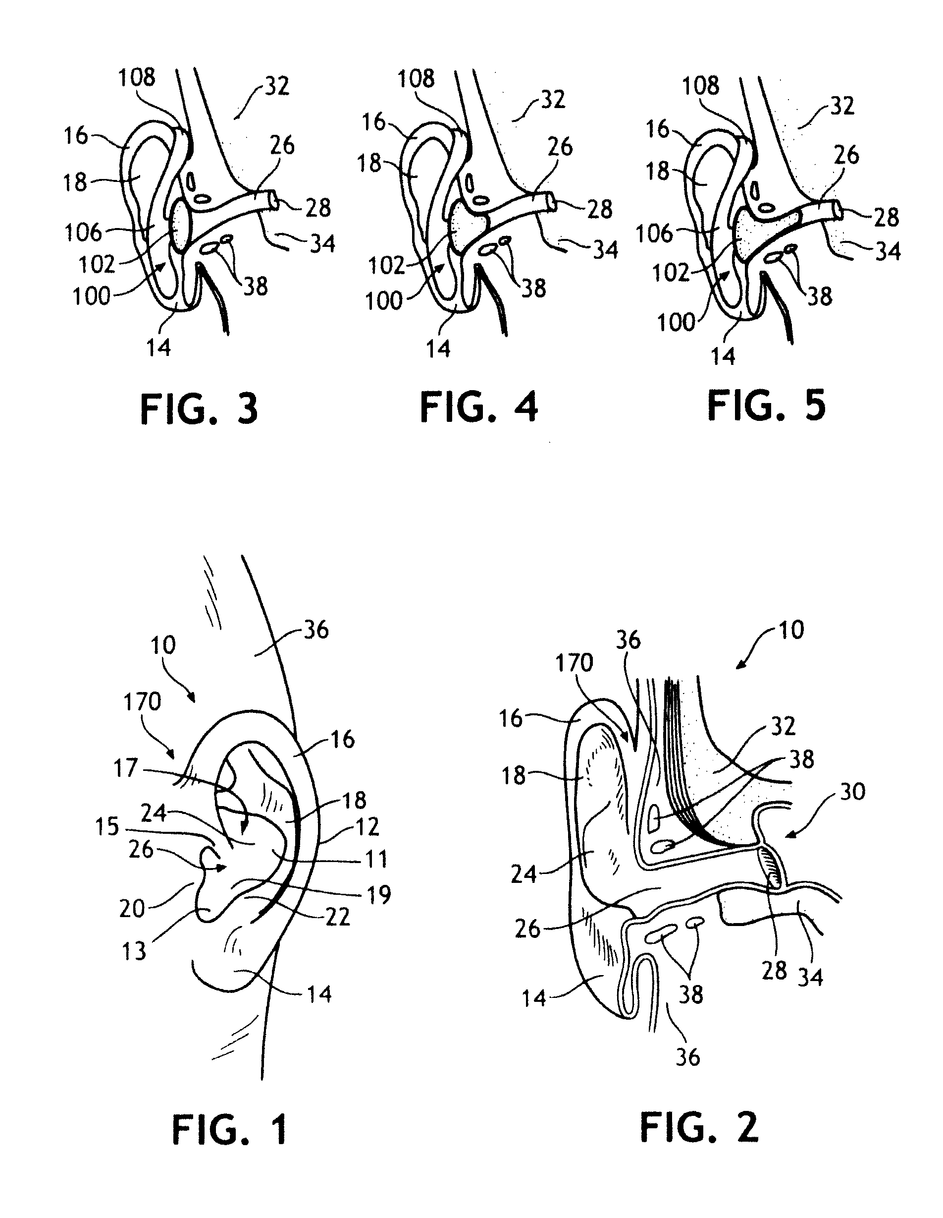 Bandless hearing protector and method