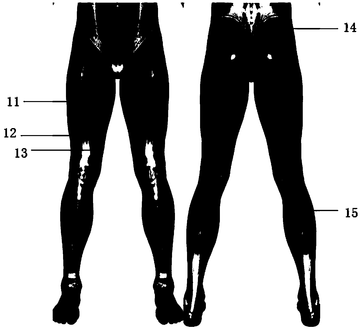 Exoskeleton walking mode identification method based on electromyographic signals