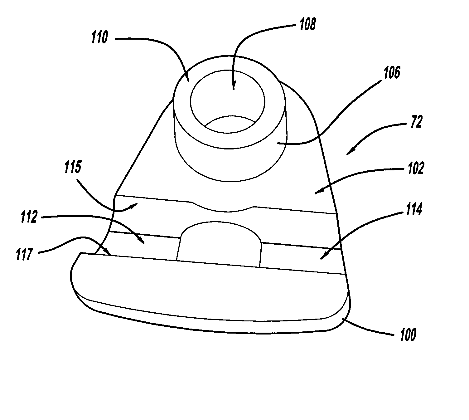 50 DN alternator stator terminal insulator apparatus