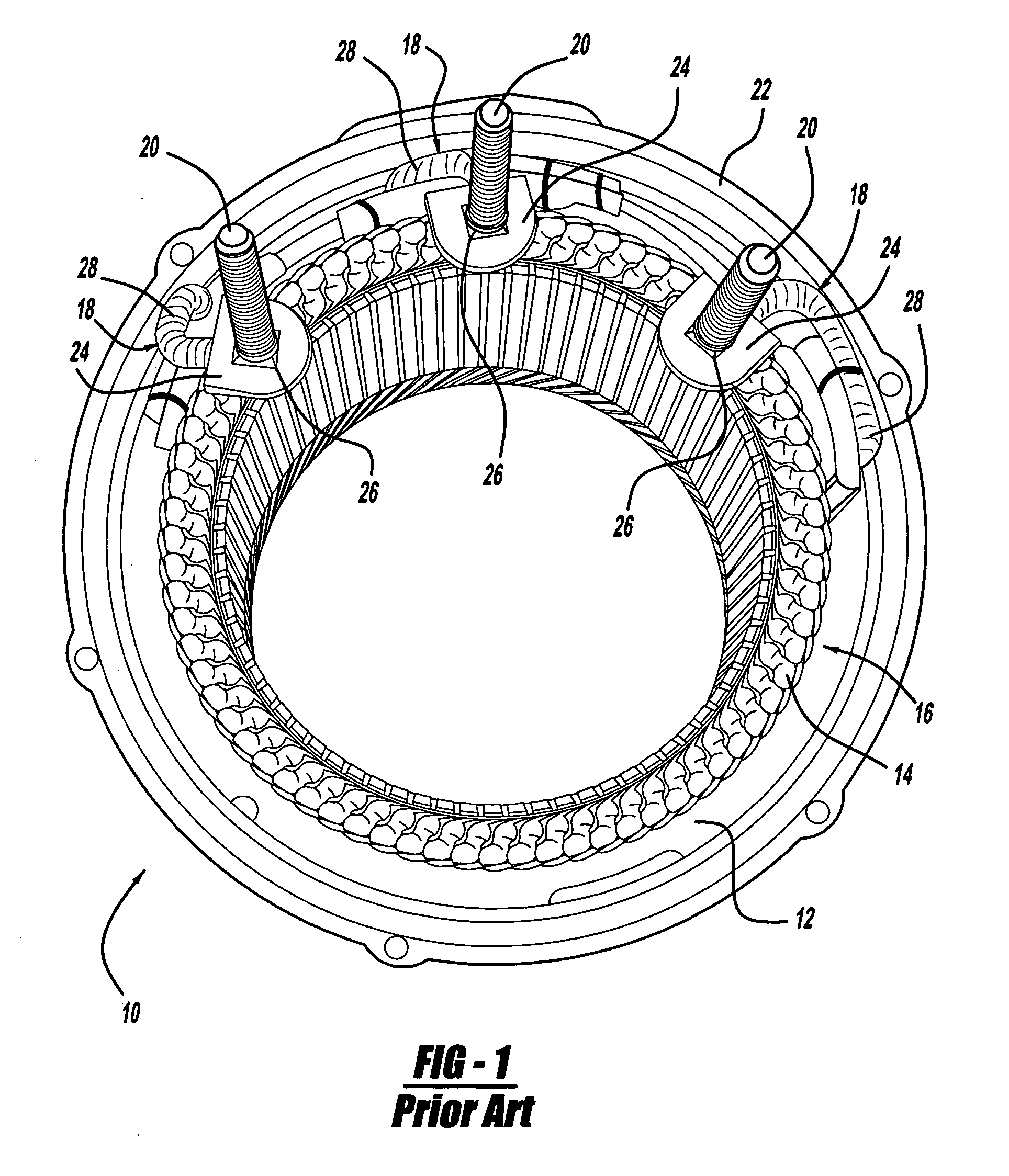 50 DN alternator stator terminal insulator apparatus