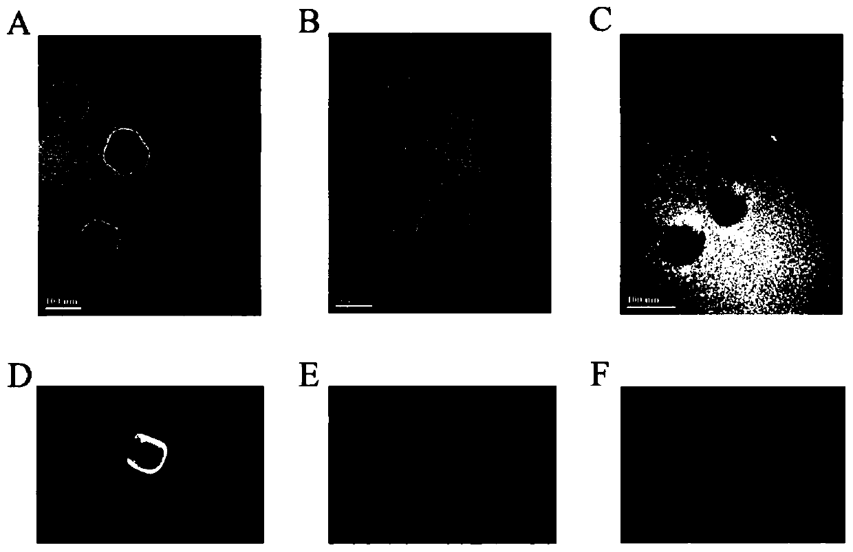 Method for preparing thermal stability vaccine based on calcium phosphate mineralization