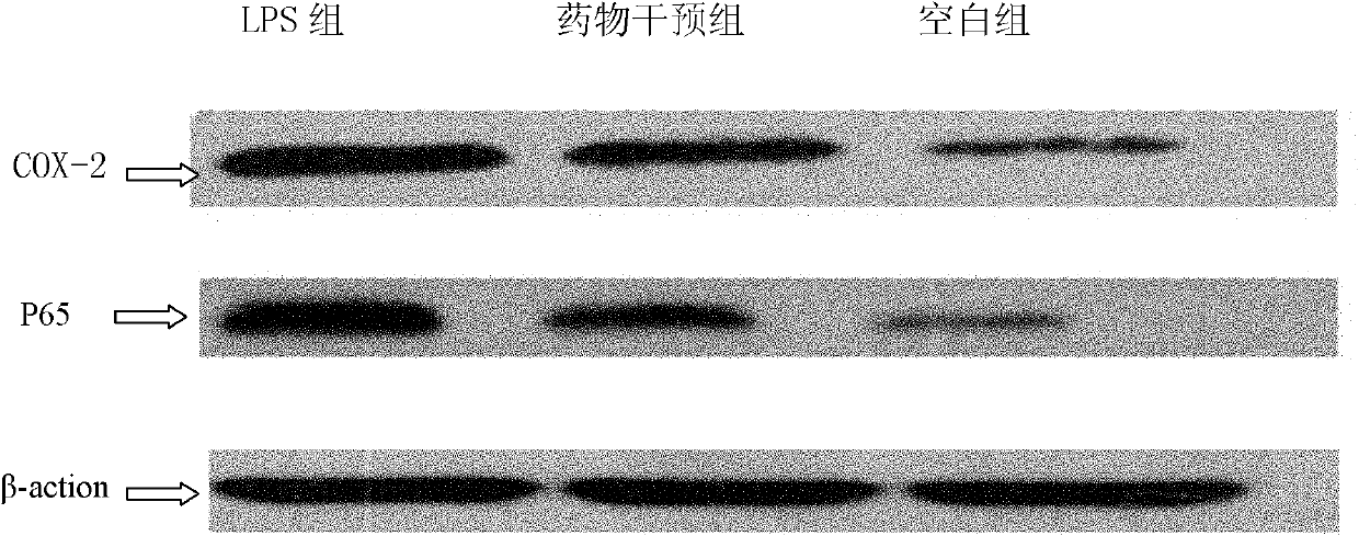 Application of curcuma wenyujin diterpene compound C in drugs for treating gastrointestinal inflammation