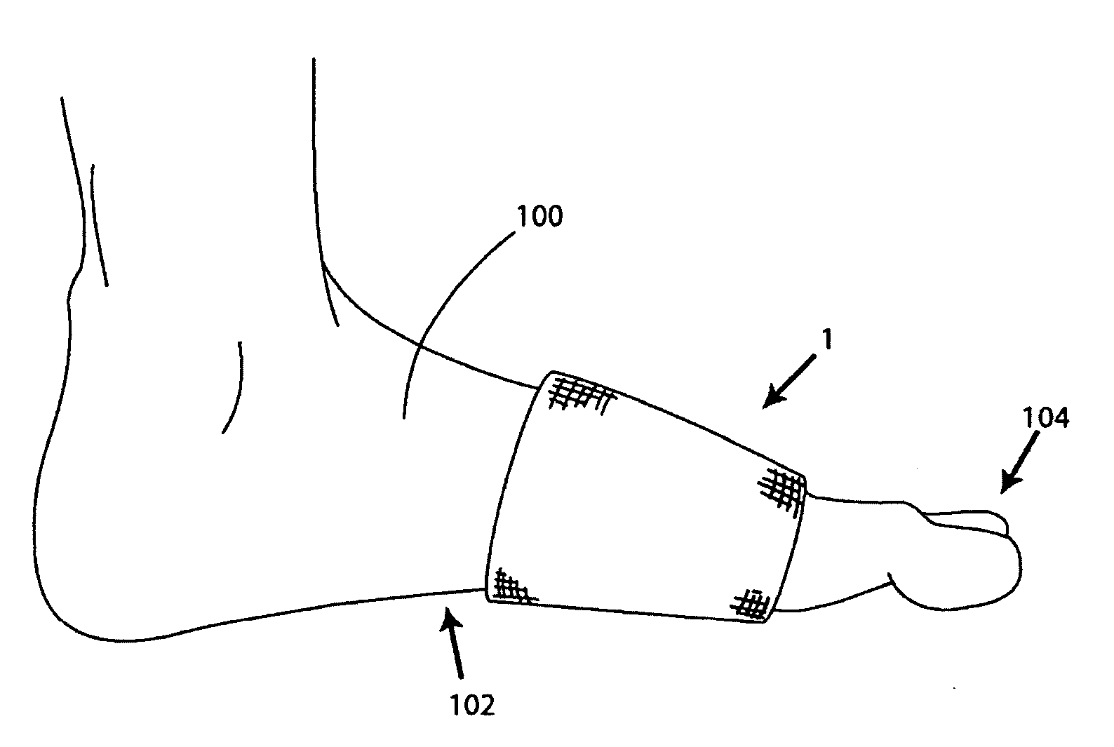 Protective foot membrane