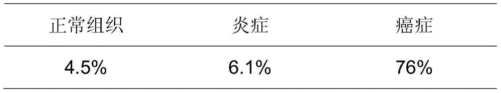 Cervical cancer prognosis test method