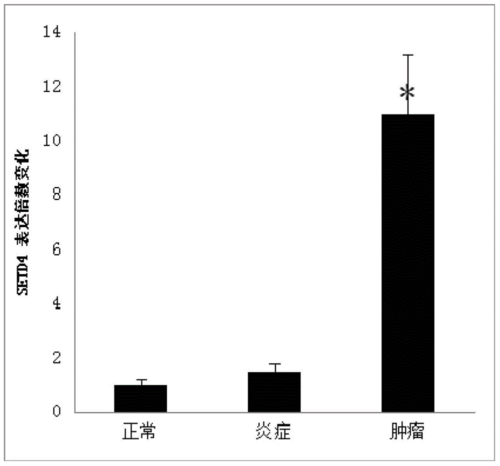 Cervical cancer prognosis test method