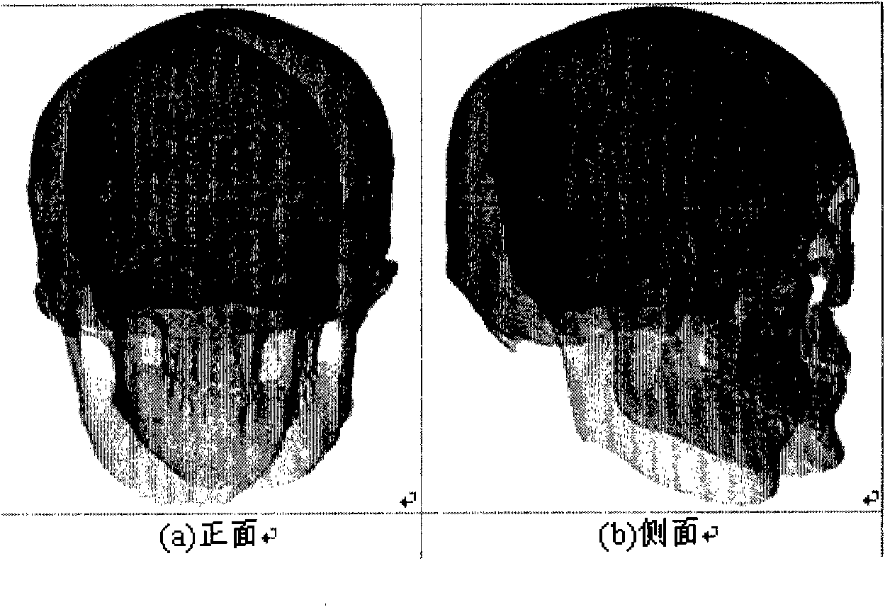 Grading-based positive and inverse reversing three-dimensional dense point set rapid registering method