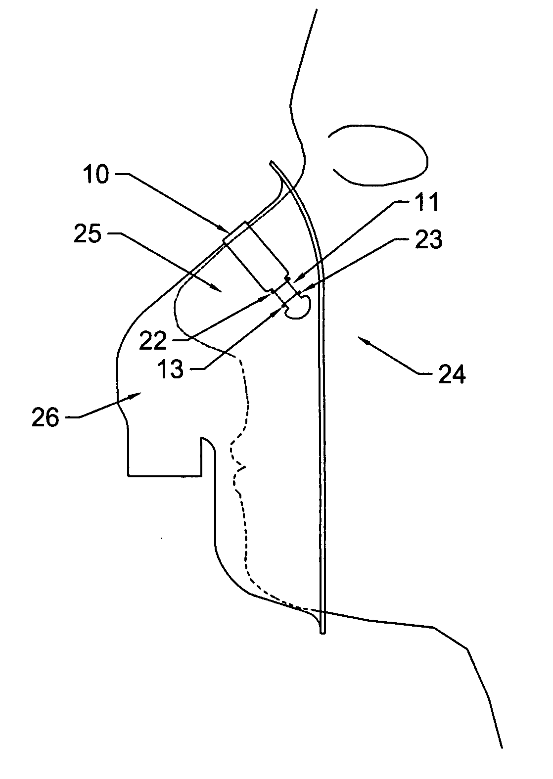 Attachment of a bridge band to an oxygen mask