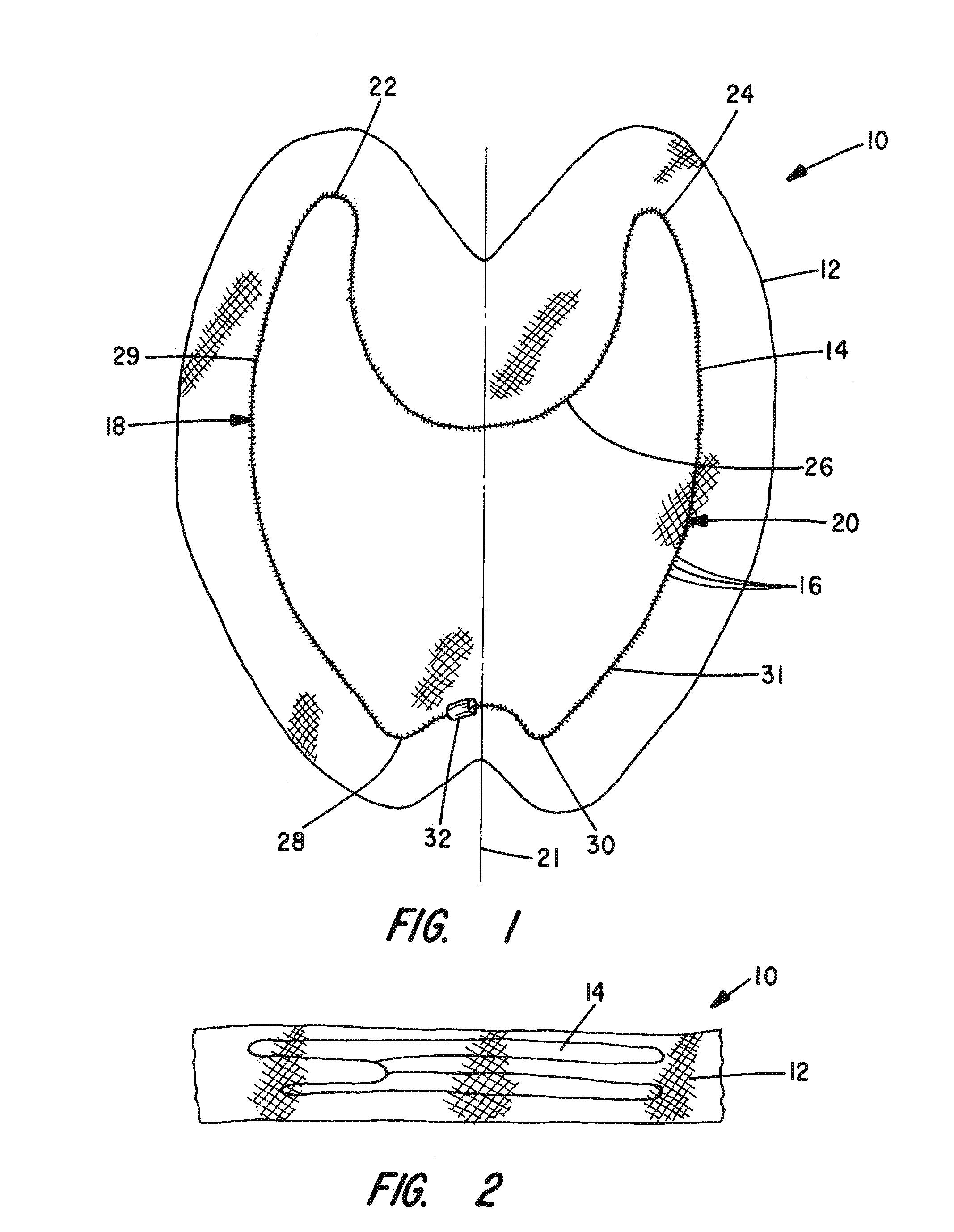 Apparatus and Method for Pelvic Floor Repair in the Human Female