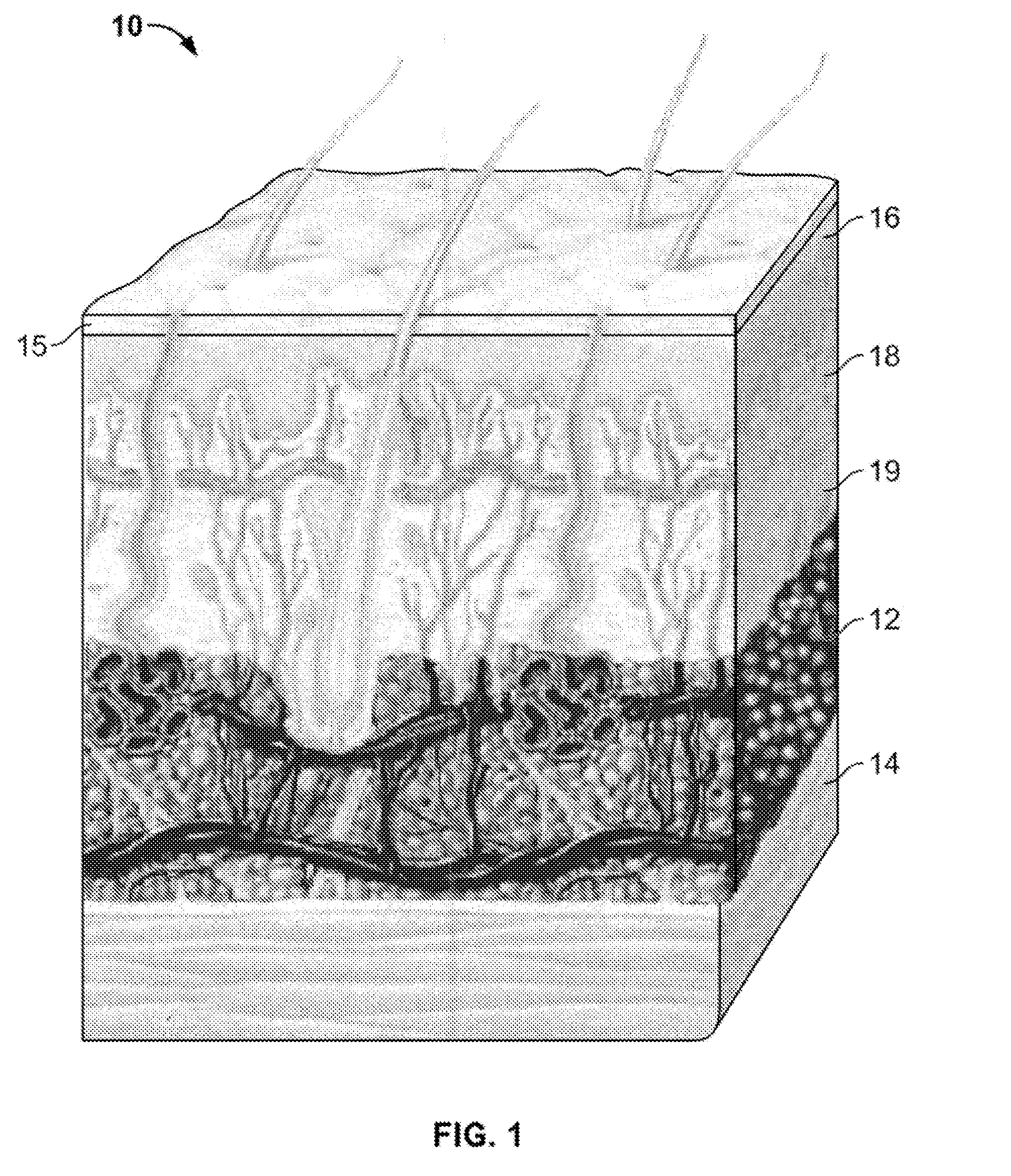 Devices and methods for percutaneous energy delivery