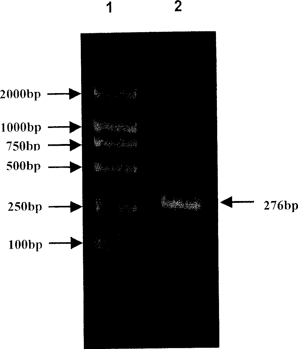 Heat shock protein 65- multiple epitope hepatitis B virus core antigen recombinant protein ú¿HSP65-HBcAgú®