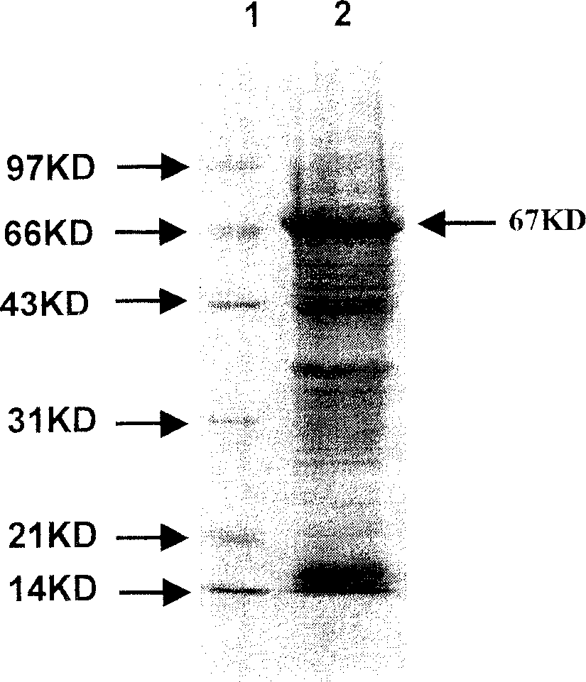 Heat shock protein 65- multiple epitope hepatitis B virus core antigen recombinant protein ú¿HSP65-HBcAgú®