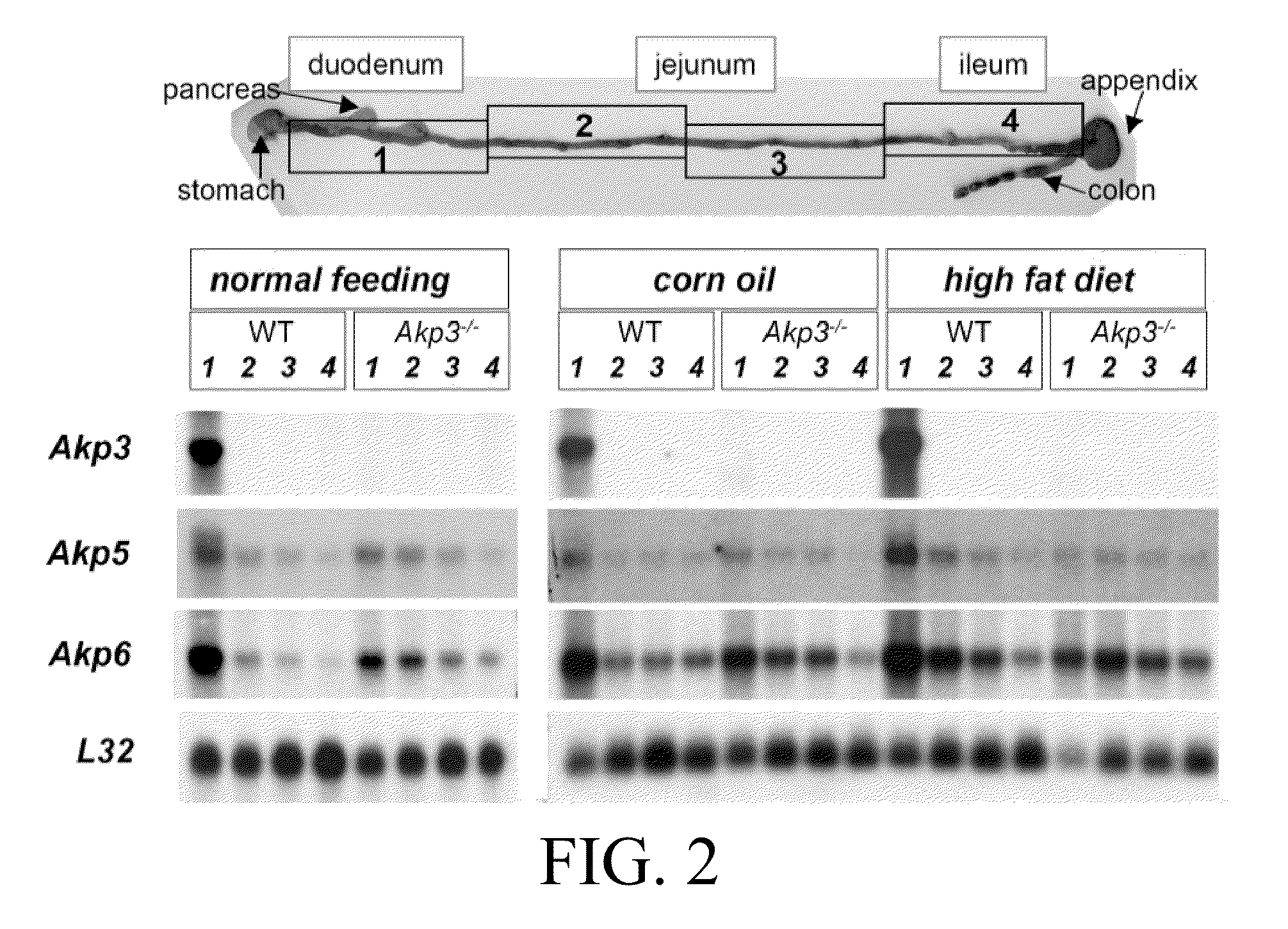 Intestinal alkaline phosphatase modulators and uses thereof