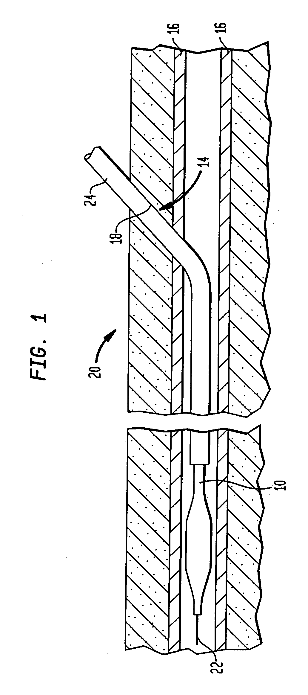 Vascular hemostasis device and deployment apparatus