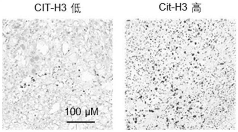 Application of CIT-H3 protein detection reagent in preparation of liver cancer prognosis and/or recurrence prediction reagent