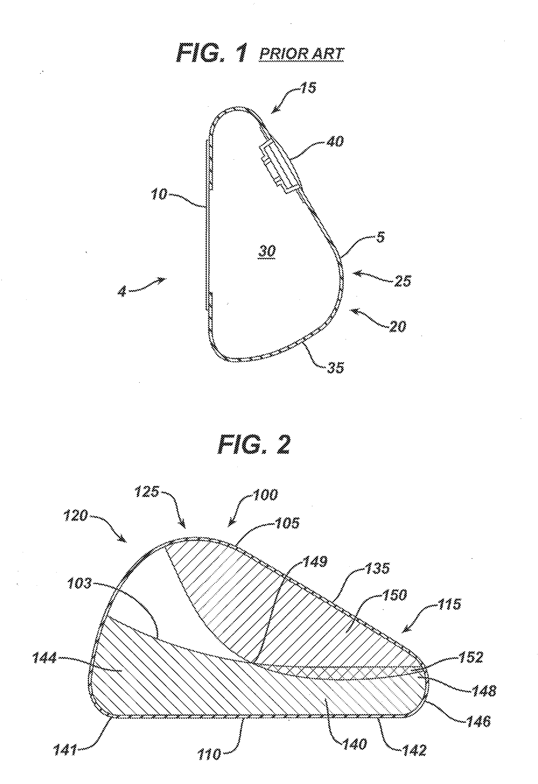 Directional Tissue Expander