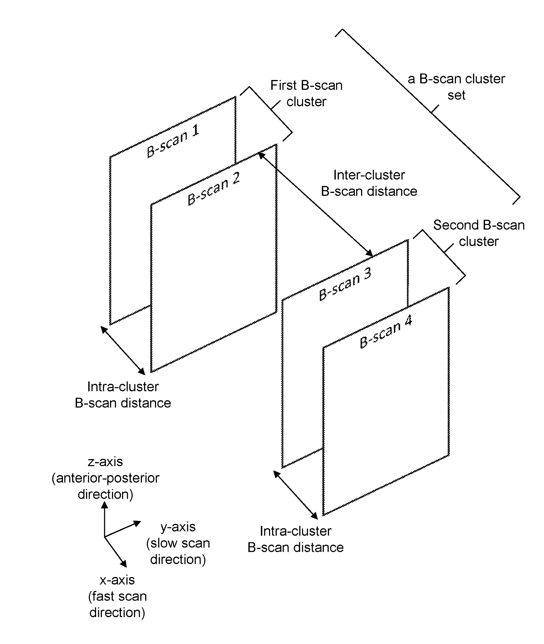 Optical coherence tomography (OCT) system with improved motion contrast