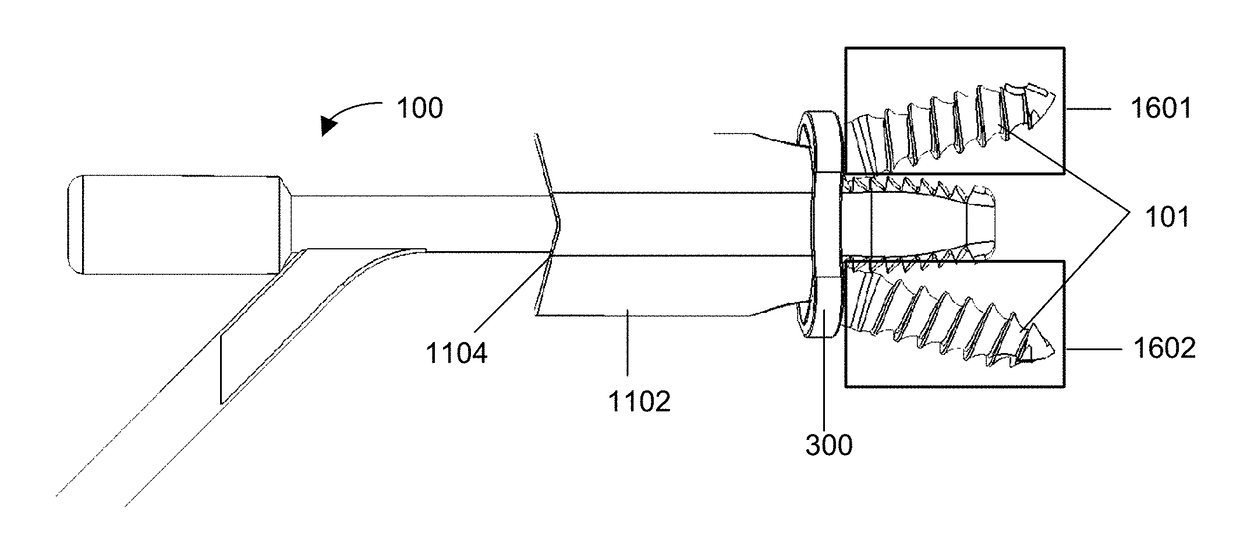 Systems and methods for adjacent vertebral fixation