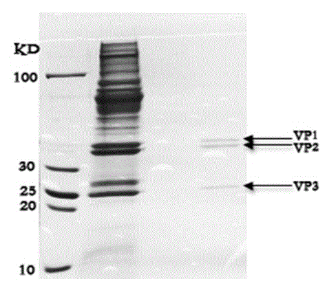 Method for purifying type 71 enterovirus