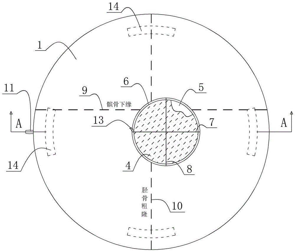 Marrow cavity puncture bag with guide positioning mark