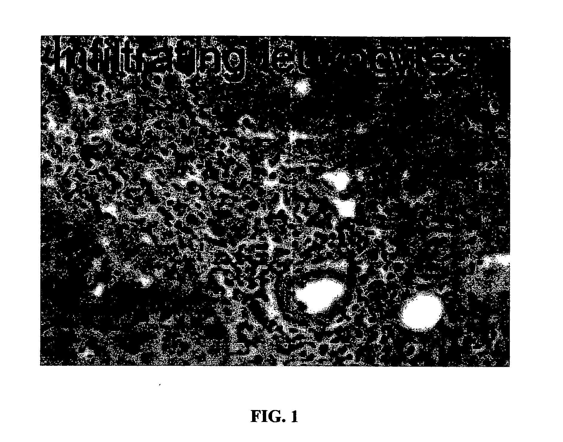 Constructs binding to phosphatidylserine and their use in disease treatment