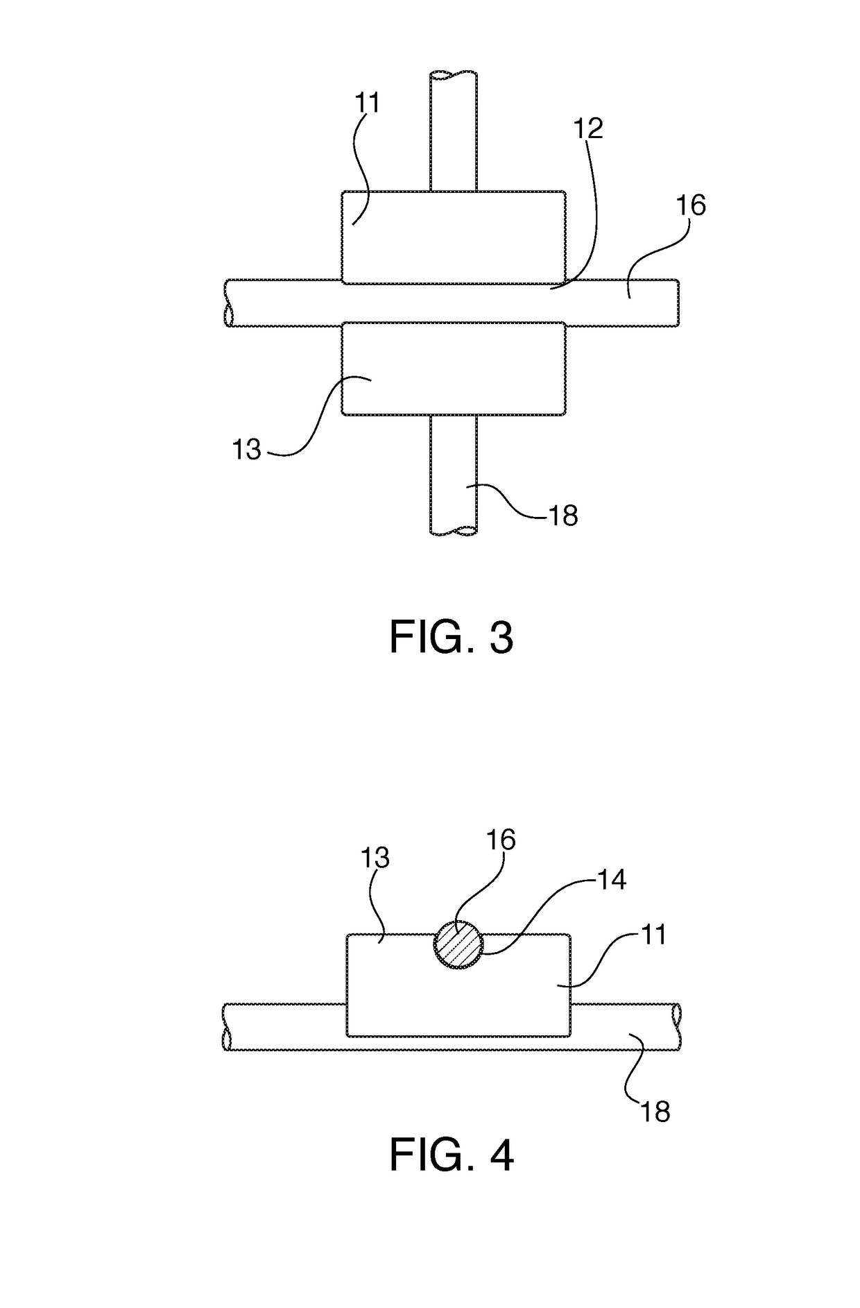 Bracket for external fixation of bones