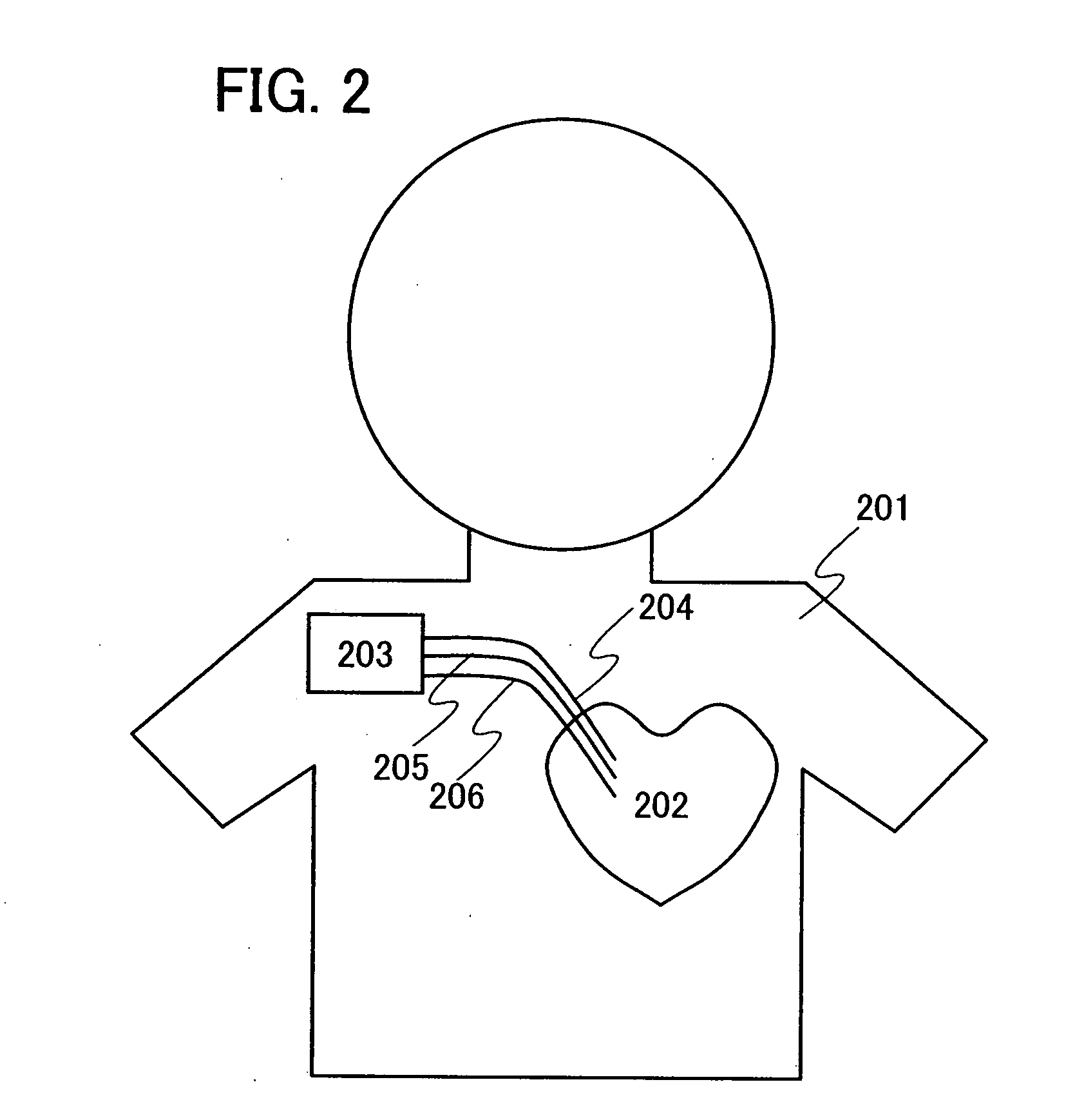 Cardiac pacemaker device