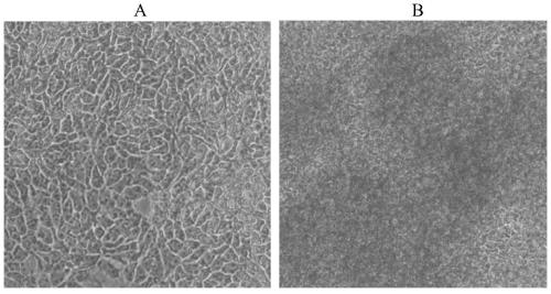 Chrysotile-induced human pleural mesothelial cell malignant transformation strain and application thereof