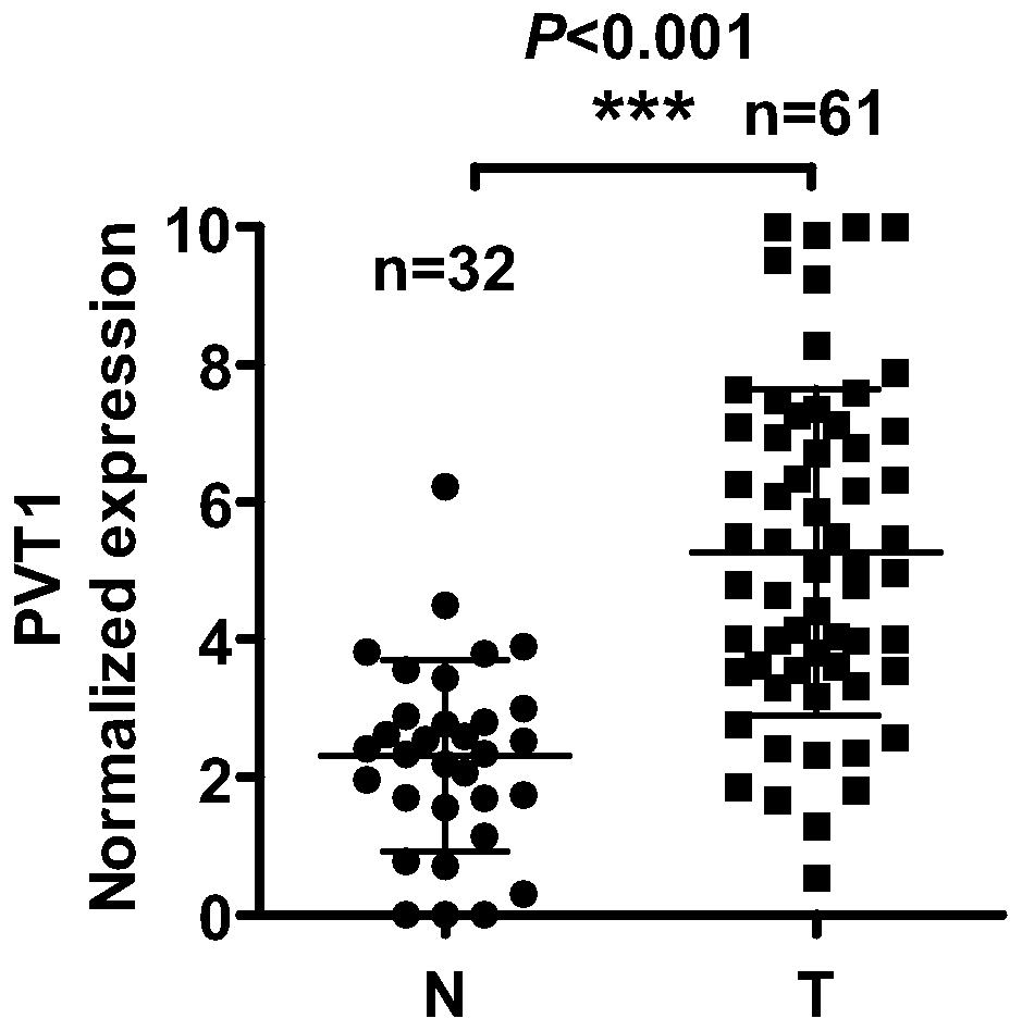 Application of reagents that interfere with the expression of long-chain non-coding RNA PVT1 in the preparation of radiosensitizers for nasopharyngeal carcinoma