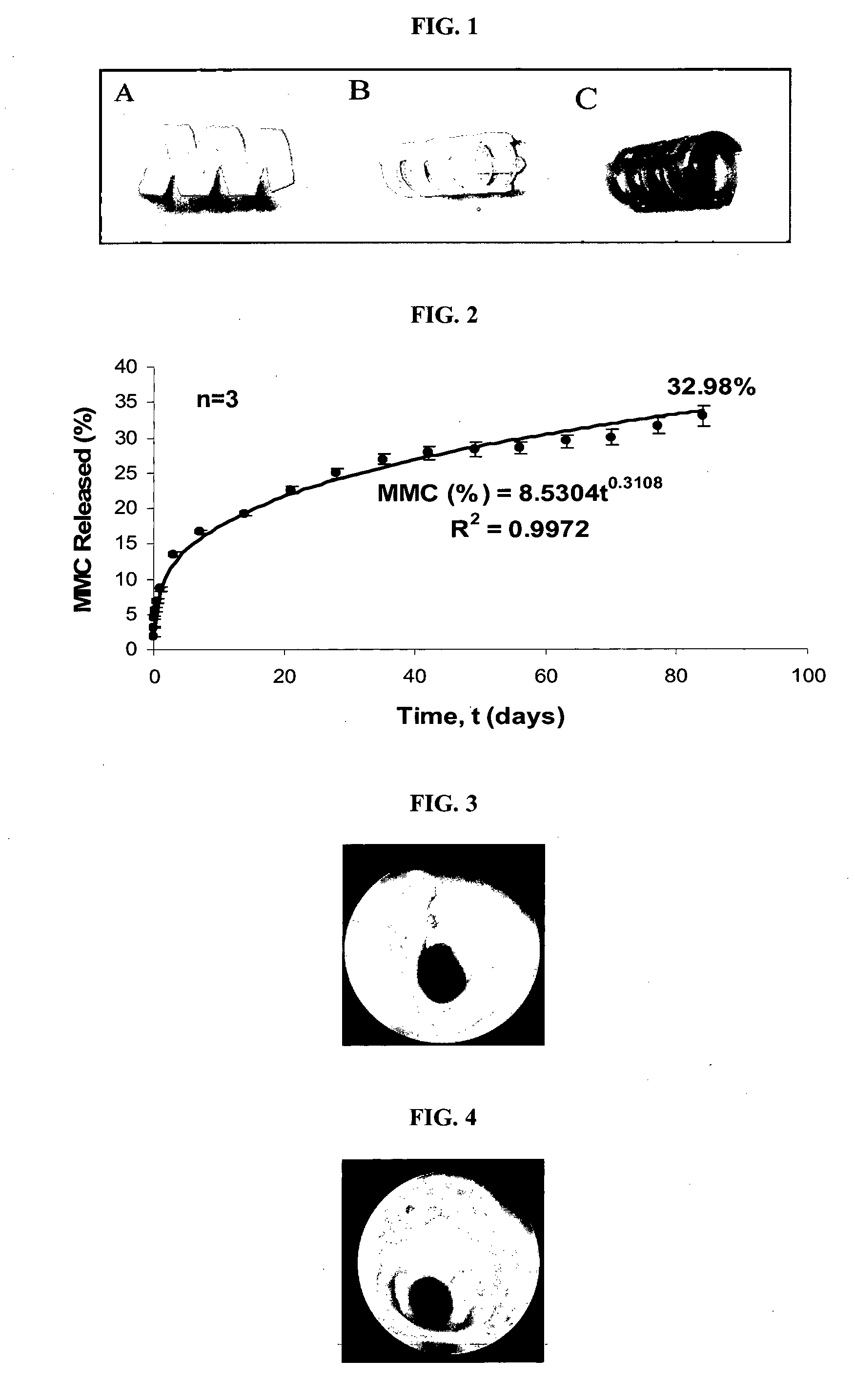 Bioabsorbable tracheal stent, and method of manufacturing thereof