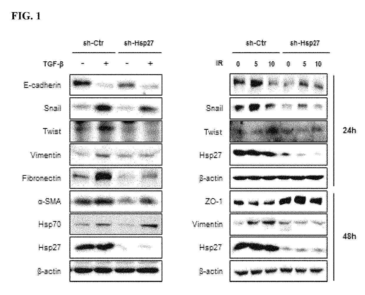 Methods for treating pulmonary fibrosis using chromenone derivatives