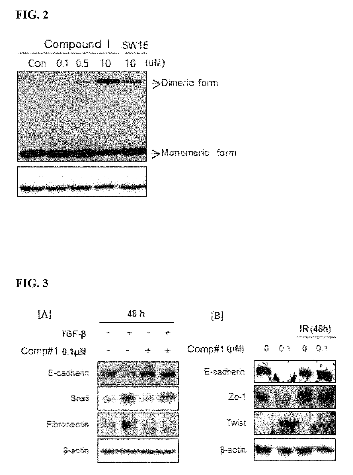 Methods for treating pulmonary fibrosis using chromenone derivatives