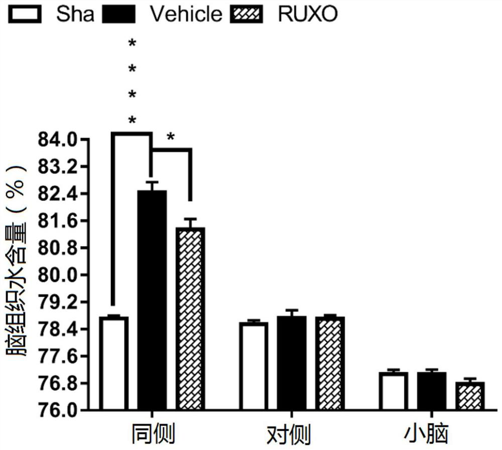 Application of jak-1 signal pathway inhibitor in preparation of medicine for treating brain injury