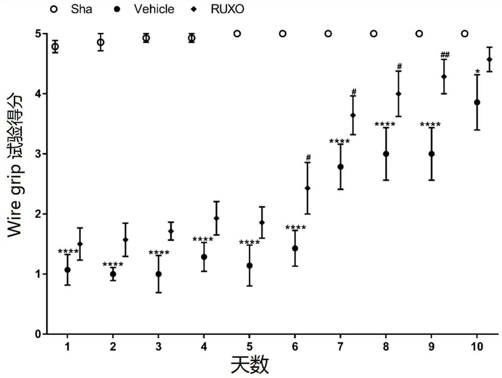 Application of jak-1 signal pathway inhibitor in preparation of medicine for treating brain injury