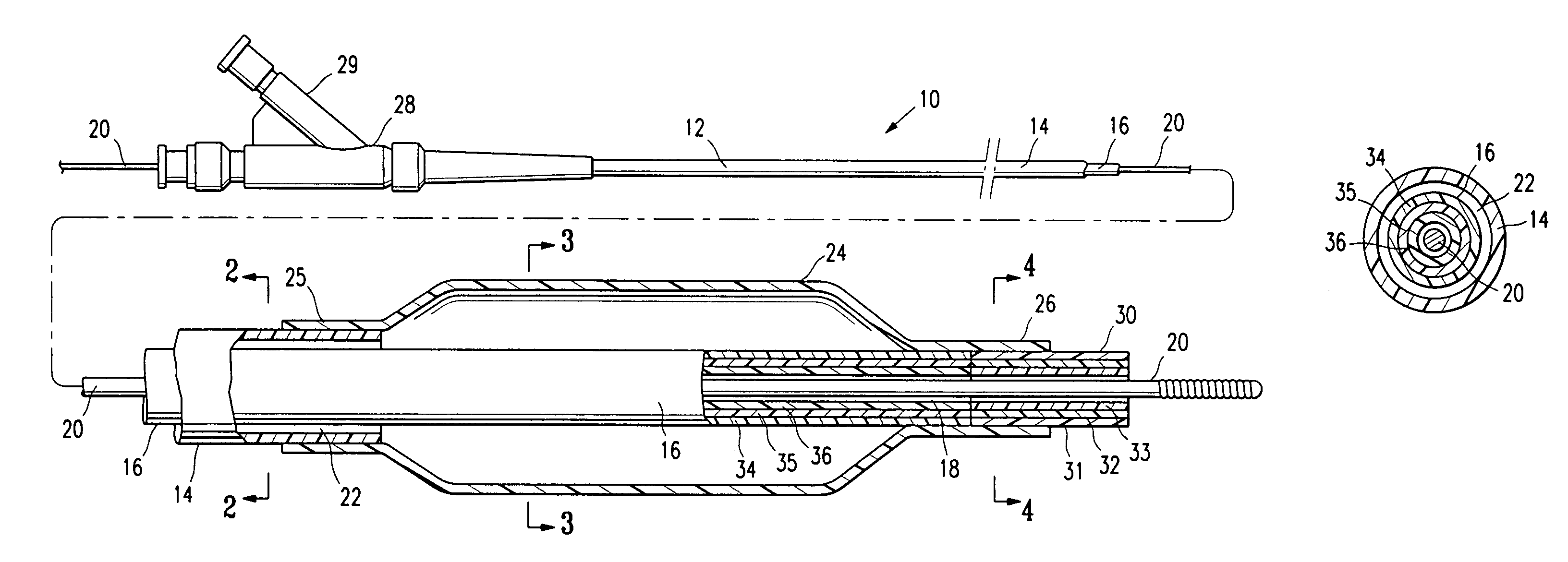 Balloon catheter having a multilayered distal tip