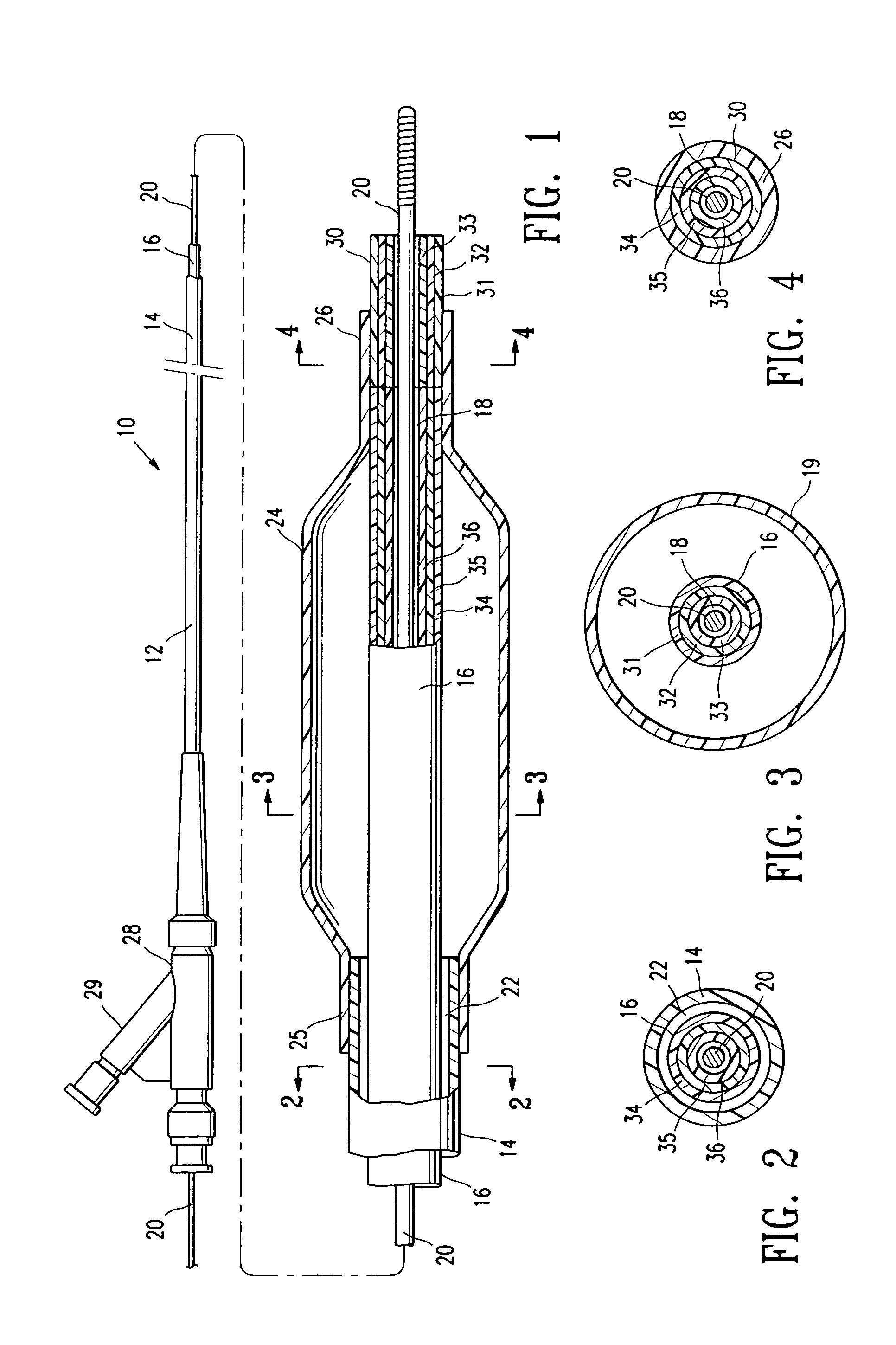 Balloon catheter having a multilayered distal tip