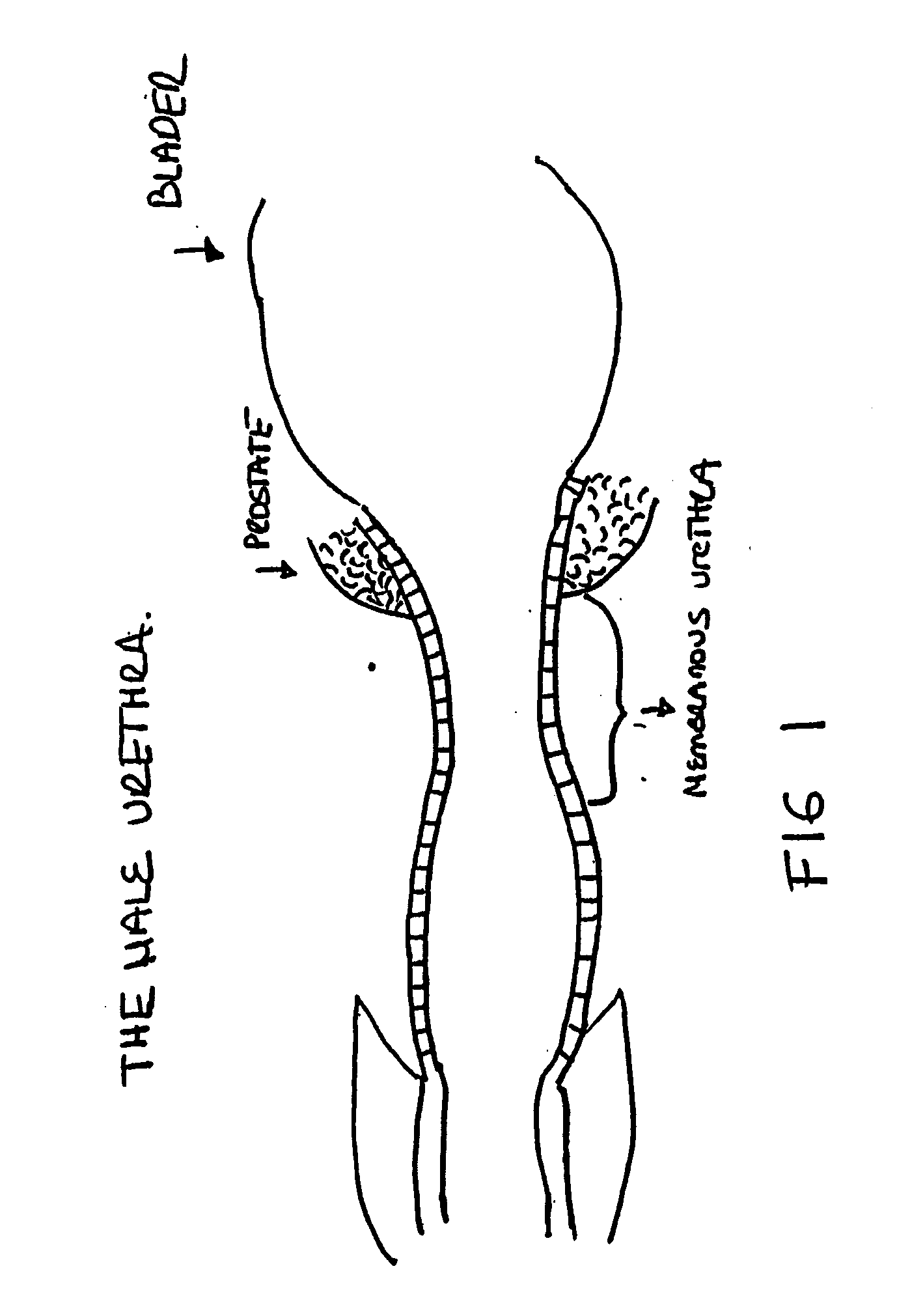 Hair undifferentiated cells