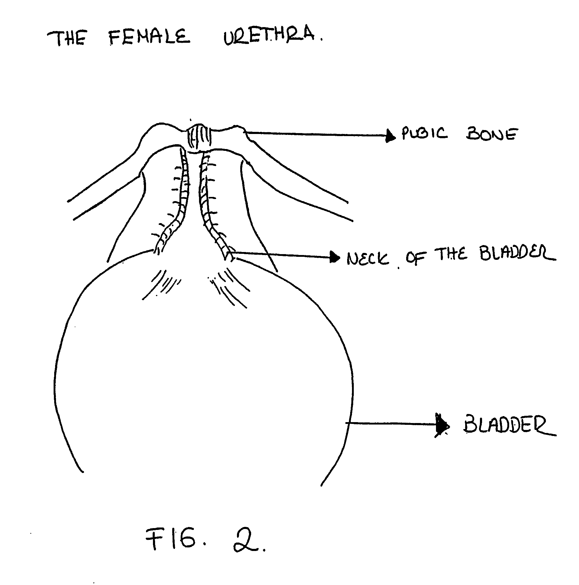 Hair undifferentiated cells