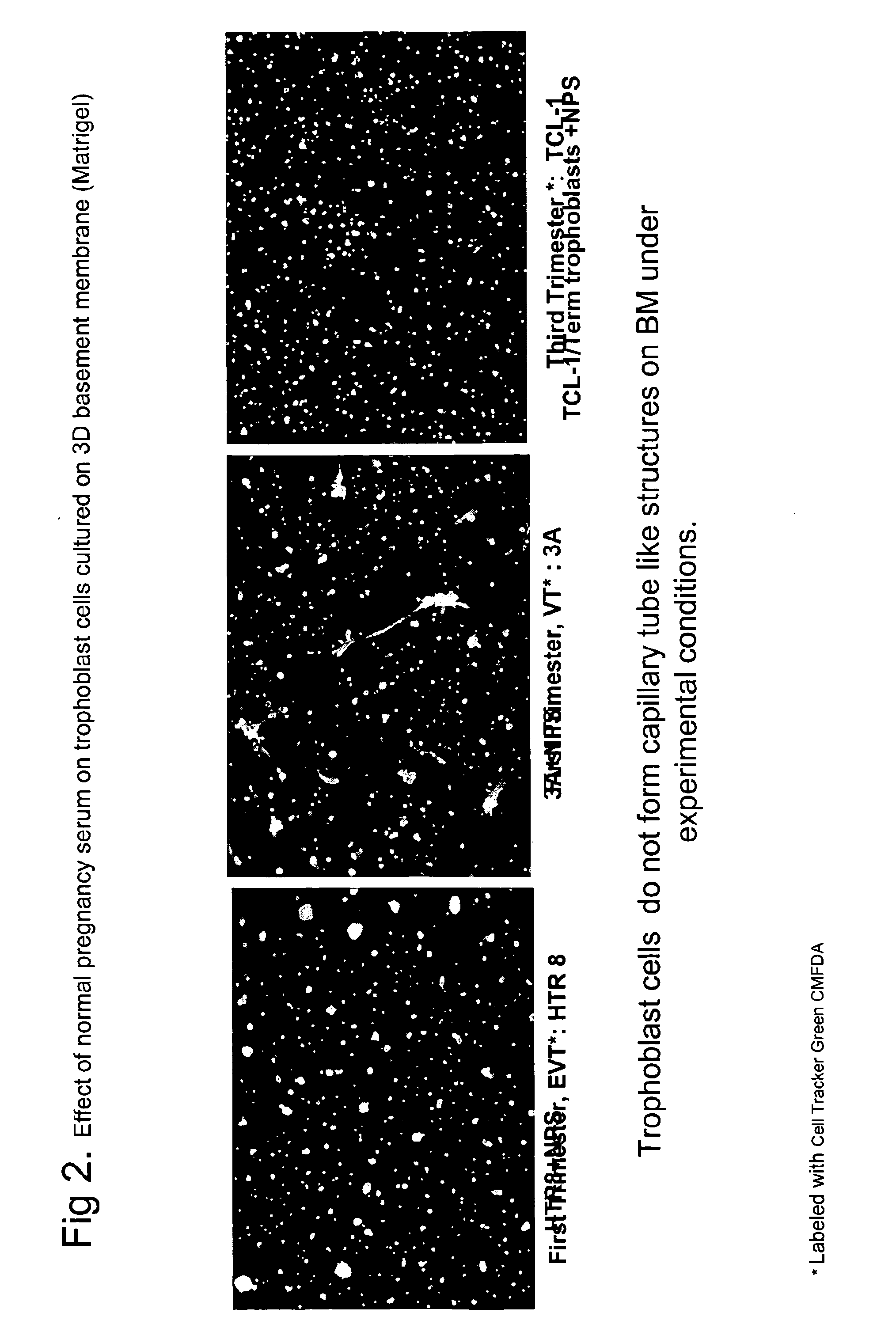 Serum-based, diagnostic, biological assay to predict pregnancy disorders