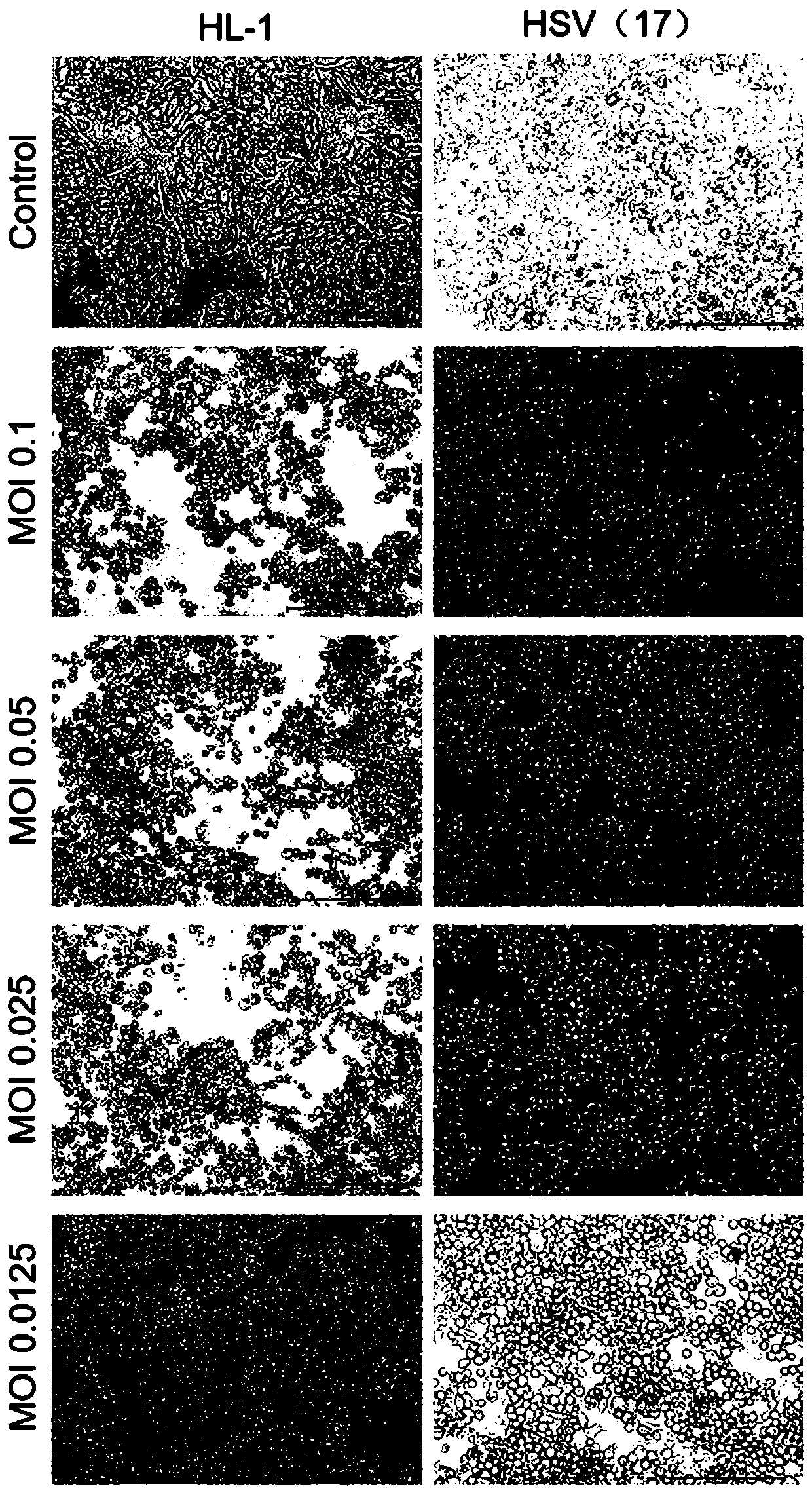 Herpes simplex virus and application thereof