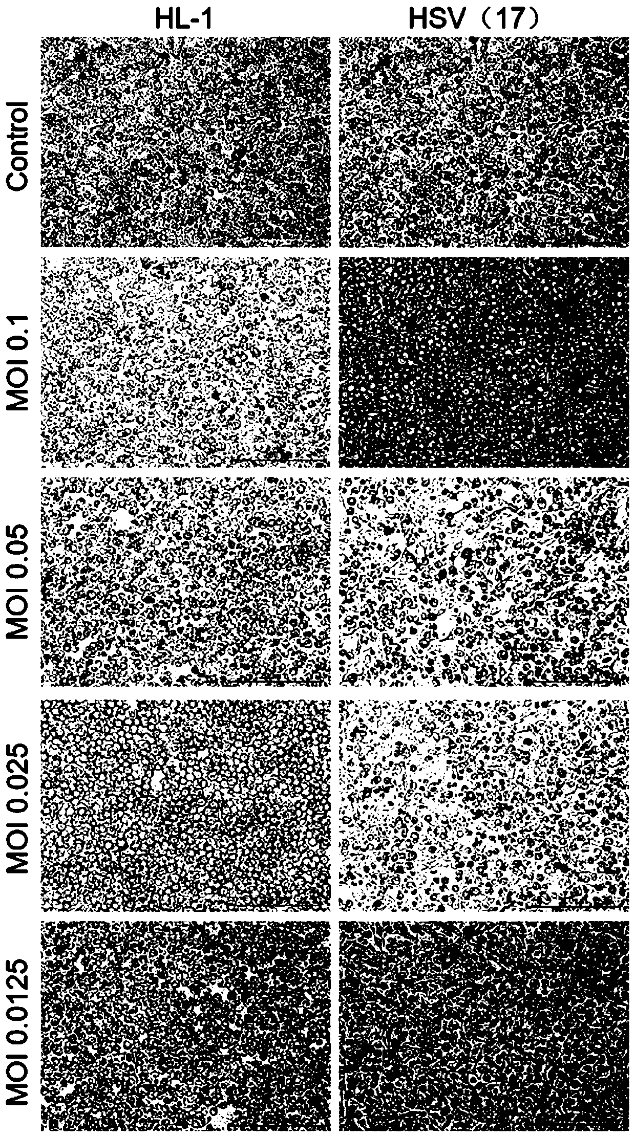 Herpes simplex virus and application thereof