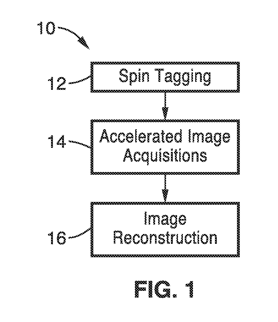 Noninvasive 4-d time-resolved dynamic magnetic resonance angiography