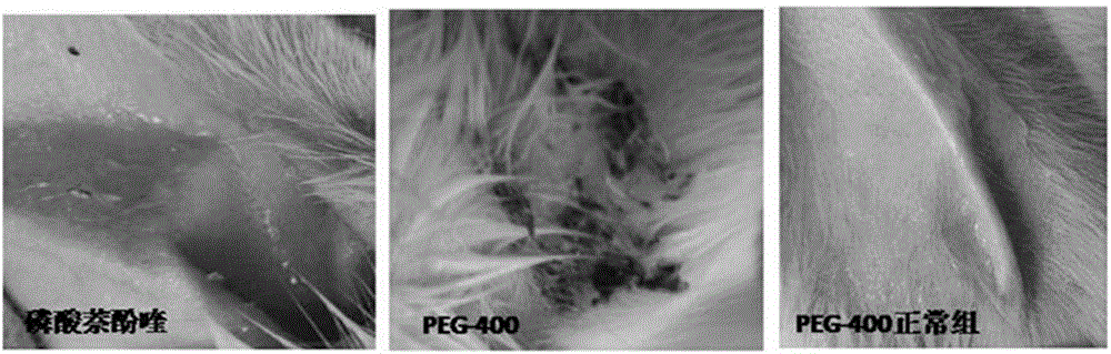 New application of naphthoquine phosphate