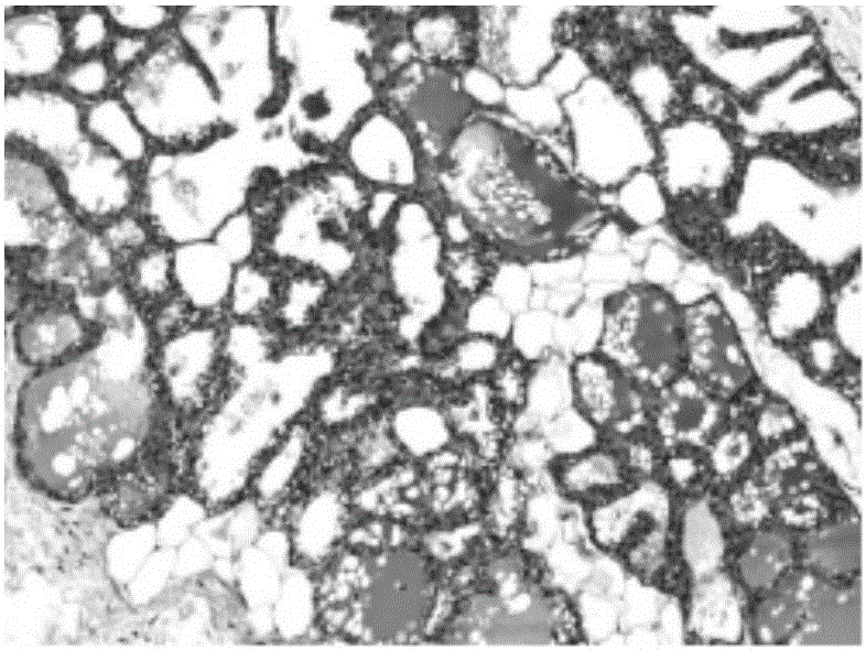 Formulation, preparation method and application of liver soothing traditional Chinese herbal medicine composition