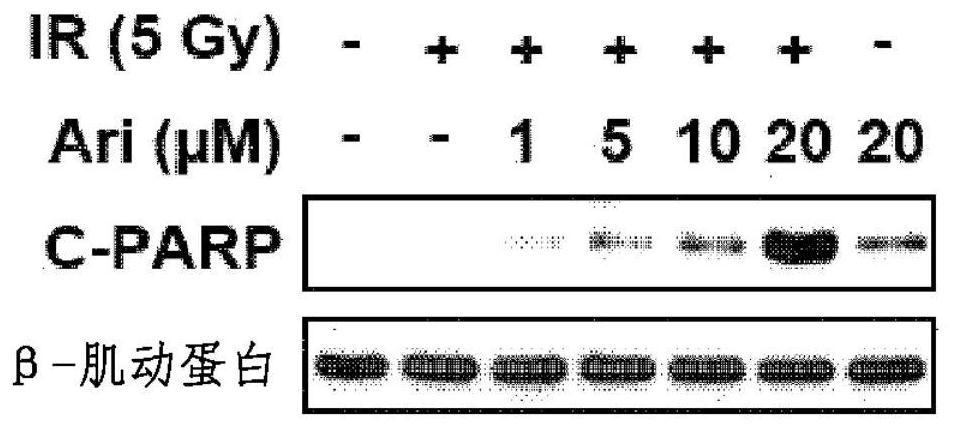 Radiation sensitivity enhancing composition containing aripiprazole as active ingredient