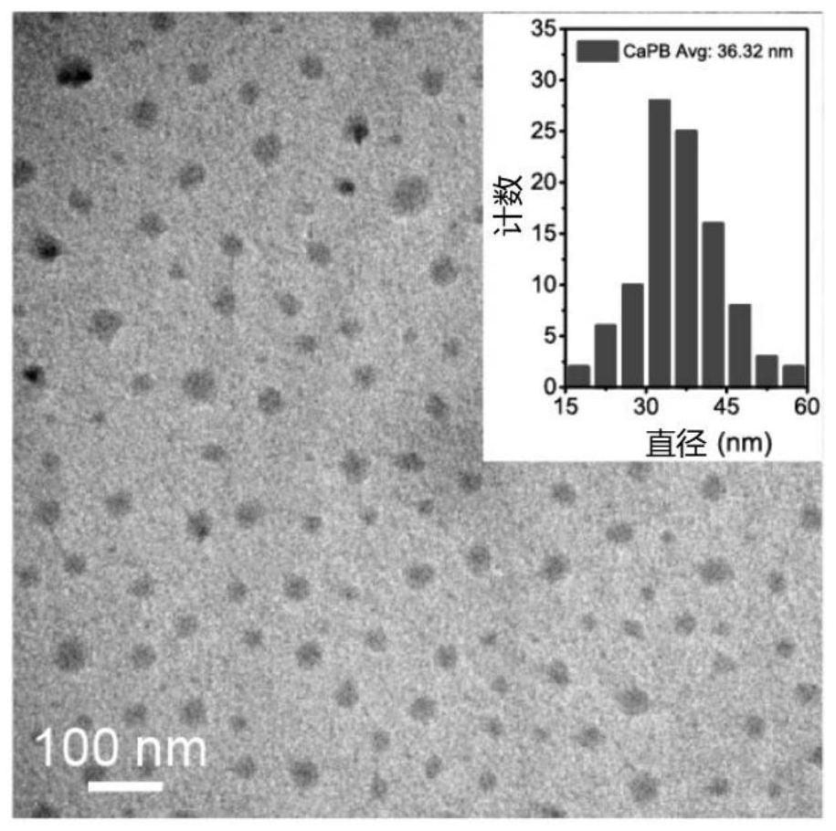 Application of CaPB nanoparticles in preparation of drugs for treating retinal degenerative diseases