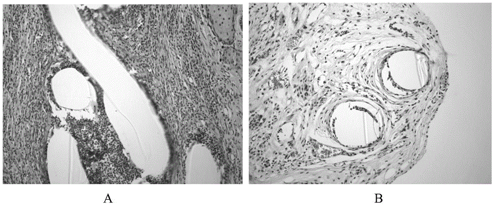 Preparation method of organic-inorganic core sheath structure compound biological material and product