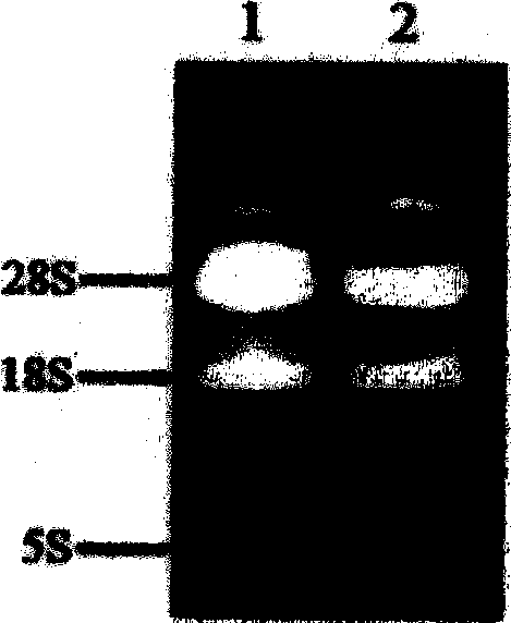 Construction method and application of tumor specific adenovirus vector carrying p21ras single-chain antibody gene