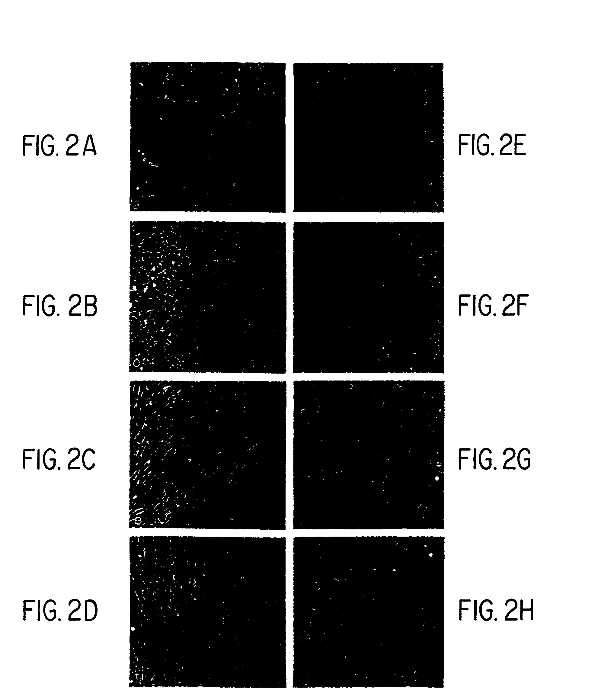 Method of preventing proliferation of retinal pigment epithelium by retinoic acid receptor agonists